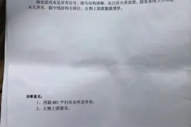 合肥一男子在界首市人民医院被诊为脑梗死，去其他医院一查竟然没病图片