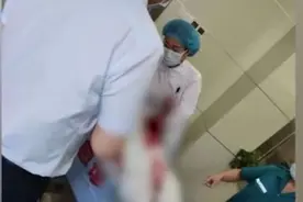 郑大一附院医生被砍 知情医护：第一刀准备刺脖子图片