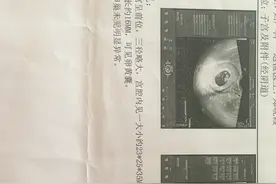 为什么说孩子是吞金兽？用我的产检经历告诉你！图片