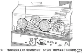 新生儿发现有黄疸，告诉您怎么办图片