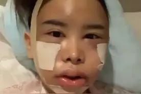 泰星Captain前女友赴韩整形 术后照判若两人图片