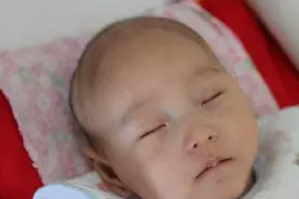 愚蠢夫妻拿闪光灯哄孩子造成视网膜黄斑区病变失明被医生大骂图片