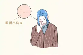 眼睛周围的“脂肪粒”，到底是啥？图片