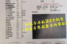 男人结扎后，和正常人有什么不一样？会影响性功能吗？涨知识了图片