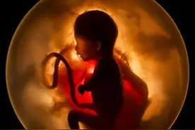 伤不起的脐带图片