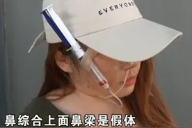 姑娘花6万做整容后，脸上只能天天挂着注射器？院方：我们没问题图片