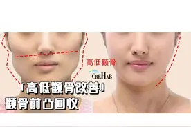高低颧骨、颧骨前凸怎么办？一个动作，回收颧骨改变脸型图片
