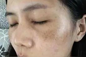 太久没“行事”导致黄褐斑？提醒：3个改变千万要注意图片