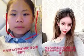 女孩13岁开始整容，3年花费百万整容60次，相貌与之前判若两人图片