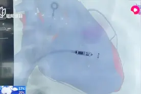 全球最小心脏起搏器，仅重2克，外形犹如“胶囊”视频封面