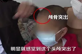 痛心！多名幼儿变“大头娃娃”，都跟喝了这种“奶粉”有关图片