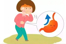 病例：咽异物感、嗳气2年，久治不愈，逐步加重致烧心、早饱图片