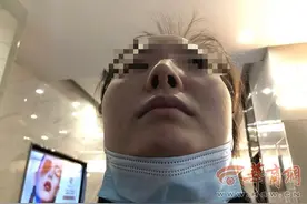 西安女子花近5万隆鼻，做了三次手术后都是歪的，自称嗅觉也不灵了图片