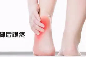 足跟疼痛难忍怎么回事？图片