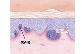 祛斑祛斑，难度一般图片