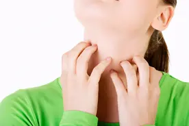 脸部皮肤过敏怎么护理？教你如何正确护理过敏皮肤图片