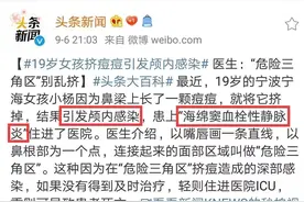 挤了一颗痘导致颅内感染！医生：长在这个区域的痘痘别乱挤图片