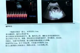 精神病患者住院时与护工发生关系并怀孕，院方：到过女方家慰问，涉事护工已开除图片