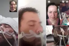 有些ICU病人，把他们从病床送去做磁共振时，他们会感觉自己被送进了烤箱图片