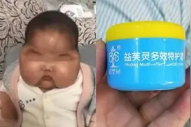 女婴使用婴儿霜后变大头娃娃，罪魁祸首是激素。婴儿霜该怎么选？图片