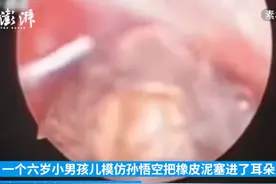 男孩往耳朵塞橡皮泥、笔头、塑料片，医生边取边劝：你不是孙悟空图片