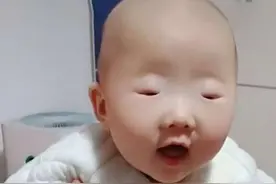 全网眼睛最小宝宝火了，李荣浩甘拜下风，网友：葡萄干吃多了？图片