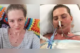 澳女子生怪病，舌头变黑呼吸困难满身皮疹，濒死时医生才找出病根图片