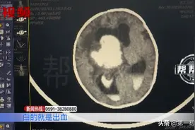刚出月子的男婴竟然脑出血，只因母亲哺乳期少吃了青菜？图片