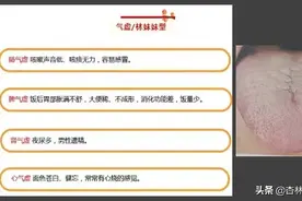 气虚、血虚、阴虚、阳虚？教你一分钟辨别图片