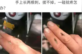 手上长了两根硬刺，请问去医院应该挂什么科？拔不掉一碰就痛图片