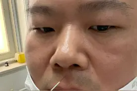 小岳岳针灸，被医生叮嘱不准笑，小编已笑疯图片