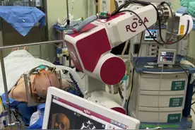 献礼医师节系列报道 | 哈医大一院神外团队完成省内首例ROSA机器人脑深部电刺激手术治疗肌张力障碍图片