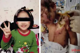 辽宁抚顺6岁女童被亲妈及男友虐待，两人涉嫌虐待罪被批捕，知情人士：男子逼迫女童吞烟头、吃猫粮、吃猫屎图片