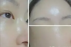 真人体验水光针：原来水光针对皮肤的改善这么大图片