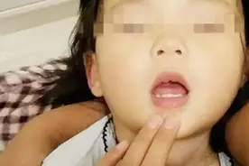 7岁外孙吃饭被鱼刺卡喉，外婆处理方式堪称教科书，获医生点赞图片