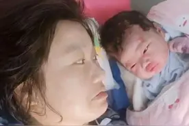 孩子小时候这些部位不好看，长大后反而颜值更高，你家占了几个图片