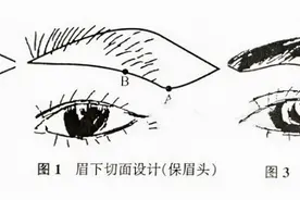 切眉、提眉有什么区别？你更适合哪种方法？图片