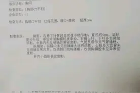 刘懿博士说肺癌（二九一五）肺结节只有CT报告能过来住院吗？图片