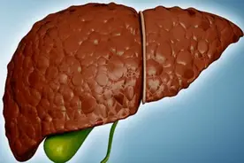 肝不好可以吃葡萄吗？医生建议：想养护肝脏，这几种食物少吃为好图片