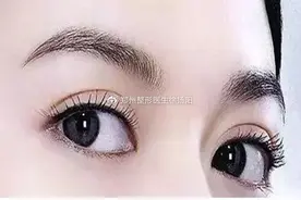 什么人不适合双眼皮吸脂？吸脂有痛感吗？图片