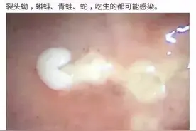 首档儿童医疗纪录片火了！10000位网友在线吐槽：快放过孩子吧图片