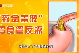 咳喘、胸痛、口苦…当心是胃食管反流在伪装！一个小招，缓解反流图片