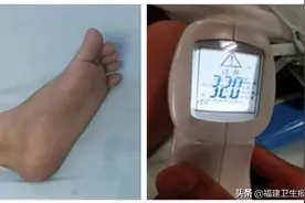 福建一男子汗多到睡觉打湿被褥！疼痛科专家用这个方法解图片