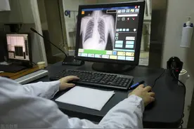 体检查出肺结节不可怕？这4种情况很危险，早发现是关键图片
