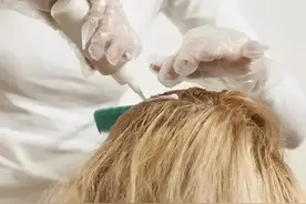 江苏女子坚持用“硫磺皂水”洗头，半年后，竟发生了这几种变化图片