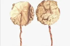 中药古今研究：紫河车图片