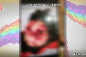 女子遭野猪袭击，正在ICU治疗，她也曾是美丽的母亲、漂亮的妻子！图片