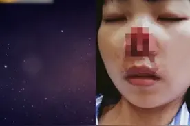 女人心软是病，得治，来自一个被丈夫咬掉鼻子的女人的忠告图片