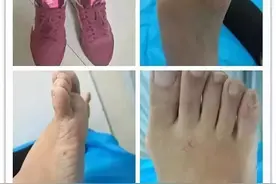 这个脚痛患者，怎么诊断？怎么处理？图片