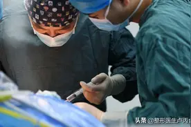 玻尿酸是如何填充前面颊三角区（苹果肌）和唇部的？图片